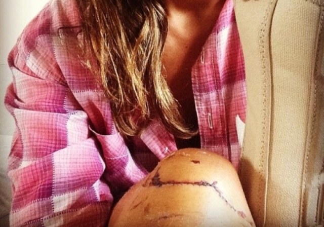 Gisele Itié sofre acidente de moto durante lua de mel na Tailândia