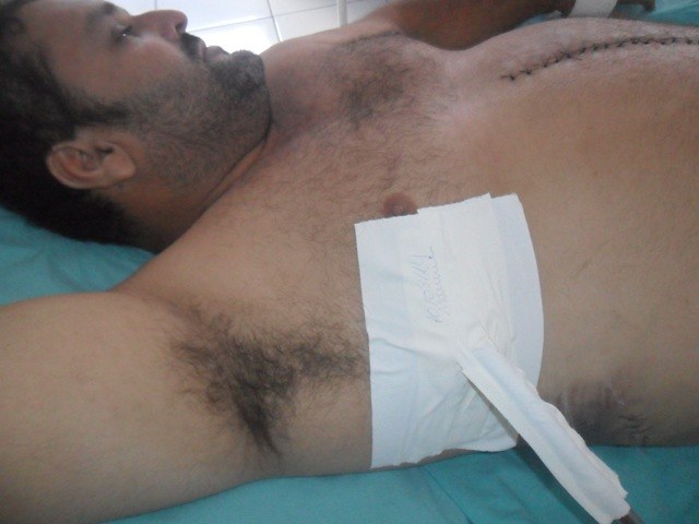 Homem que sobreviveu a tiros e facadas em Cabixi tem bala alojada na cabeça