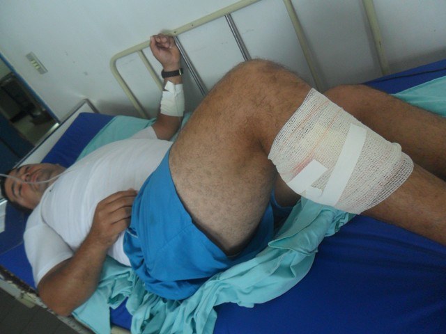 Taxista ferido durante tiroteio em bailão estava assistindo primo tocar