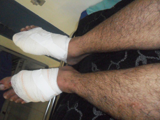 Rapaz de 23 anos tem pés prensados por máquina no Aterro Sanitário de Vilhena