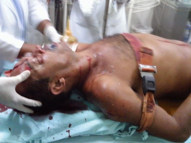 IMAGENS FORTES: CIRURGIA NUEROLÓGICA DE EMERGÊNCIA SALVA DEFICIENTE