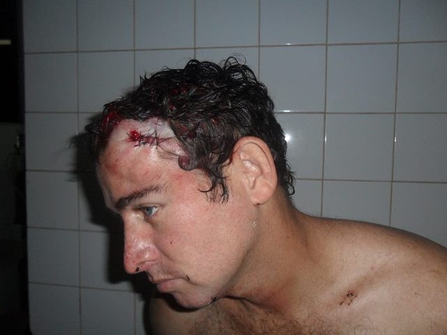 Homem tenta evitar briga e leva tacada de sinuca na cabeça em bar da periferia