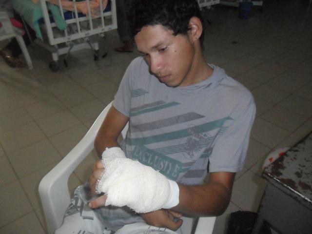 Completamente pelado, comerciante persegue e ataca ladrão a facãozadas