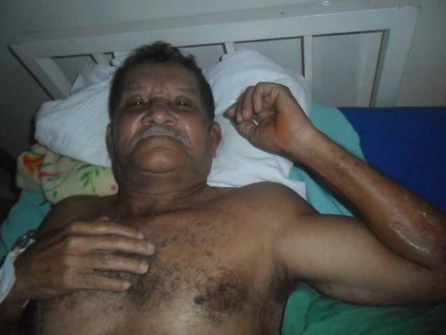 De bicicleta, homem de 70 anos é atacado por cachorro em rua de Cerejeiras