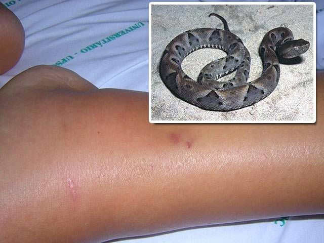 COBRA MATA CRIANÇA DE QUATRO ANOS