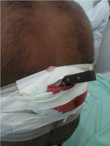 Em Chupinguaia, mulher diz ter sido estuprada e crava faca nas costas de homem