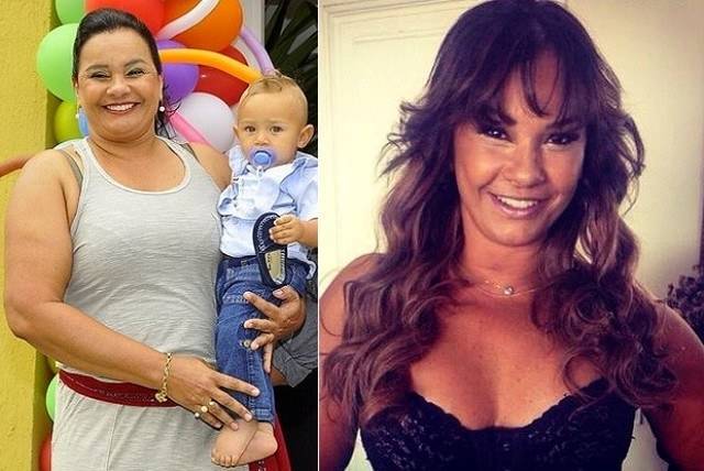 Solange Couto faz plástica após perder 43 quilos: "Só não mexi no rosto"