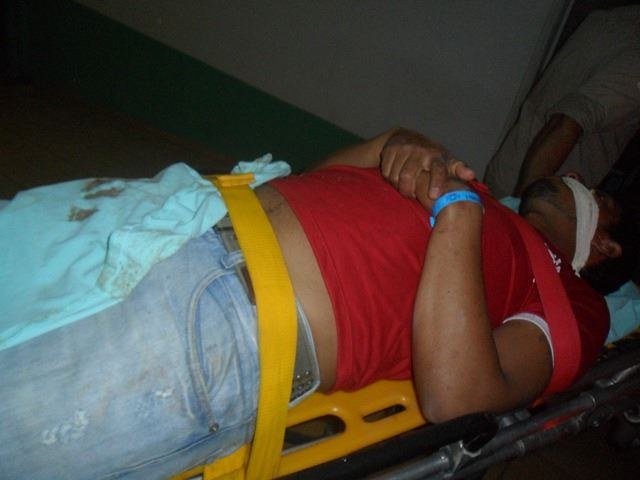 Jovem de 20 anos leva tiro no rosto na Expovil; menor teria feito disparo