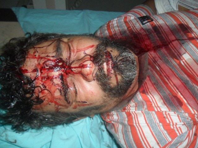 Vilhena: homem escapa da morte ao se esconder em igreja após ataque de colega