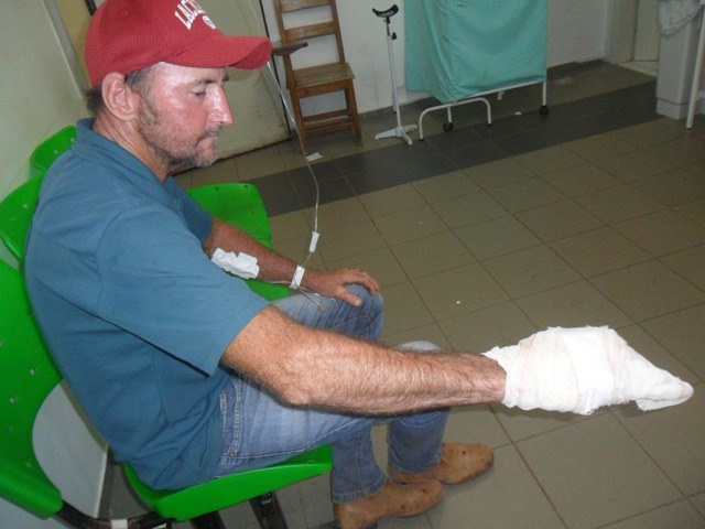 Homem tem a mão atingida pela própria arma na zona rural de Cabixi