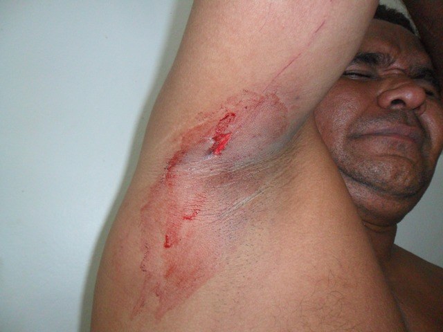 Rapaz é esfaqueado após discutir preço de corrida com taxista em Vilhena