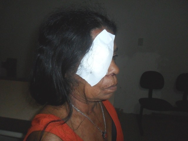 Viúva de 55 anos fica ferida ao tentar reagir a assalto na periferia de Vilhena