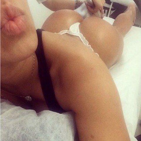 Mulher Melão exibe bumbum durante tratamento estético