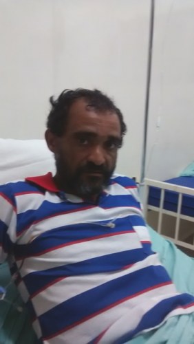 Árvore derrubada por ventania quase decepa perna de sitiante em Corumbiara
