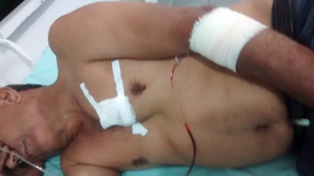 Baleado, caminhoneiro vilhenense dirige mais de 100 km em busca de socorro