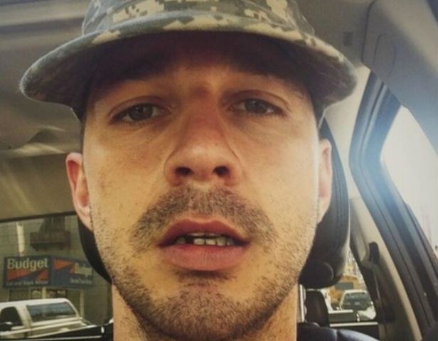  Shia LaBeouf arranca dente e corta o próprio rosto para personagem
