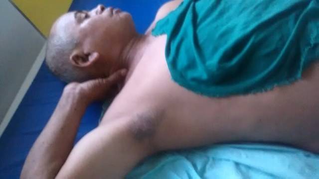 Agricultor de 54 anos se fere sozinho e quase morre por falta de socorro