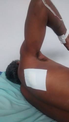 Homem de 36 anos é esfaqueado por vizinho na zona rural de Corumbiara