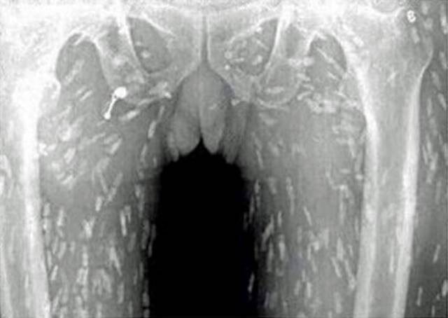 PARASITAS