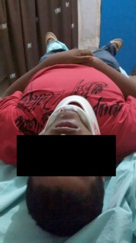 Adolescente de 16 anos cai de arquibancada durante show sertanejo em Vilhena