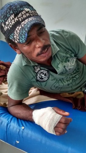 Homem vai parar em hospital de Vilhena após ser atacado por Pit Bull da irmã