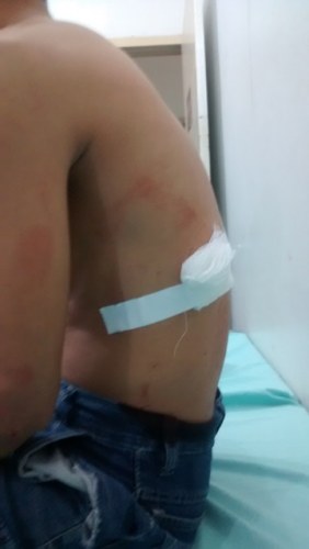 Vilhena: homem é esfaqueado pelo próprio irmão em bairro da periferia