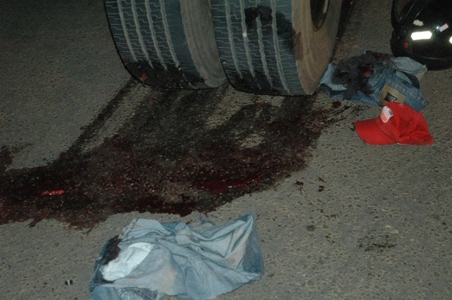 Morre em Porto Velho o vilhenense que teve perna dilacerada em acidente
