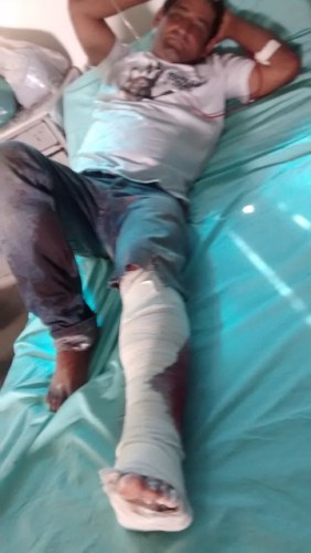 Braçal baleado em Vilhena ontem diz: “Tentaram me matar a tiros por engano”