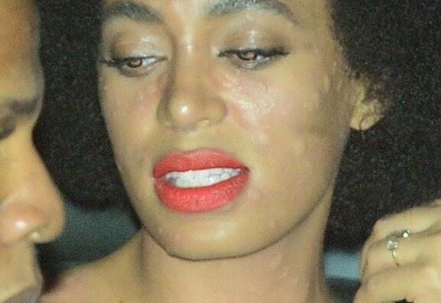 Irmã de Beyoncé tem reação alérgica no rosto no dia do casamento