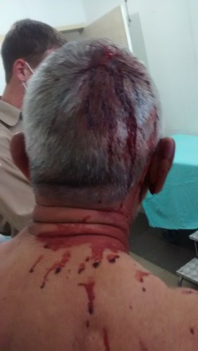 Vigilante de escola tem casa invadida e fica ferido ao lutar com desconhecido