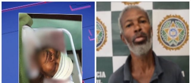 ESCAUPELAMENTO 
