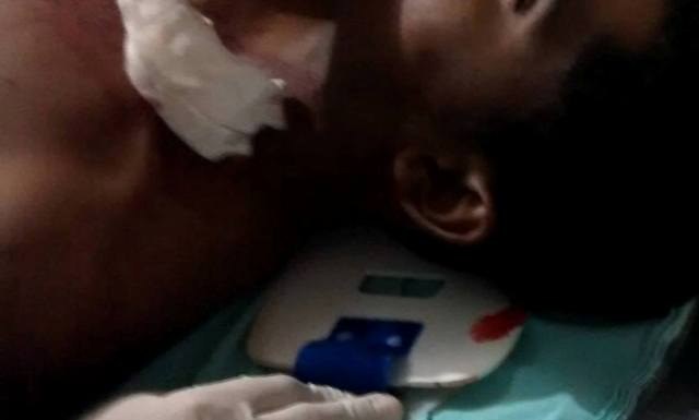 Menor baleado provoca pânico em hospital de Vilhena: ameaça de invasão 