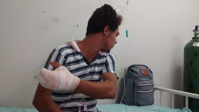 Estudante de 17 anos quase perde a mão ao usar bomba para espantar araras