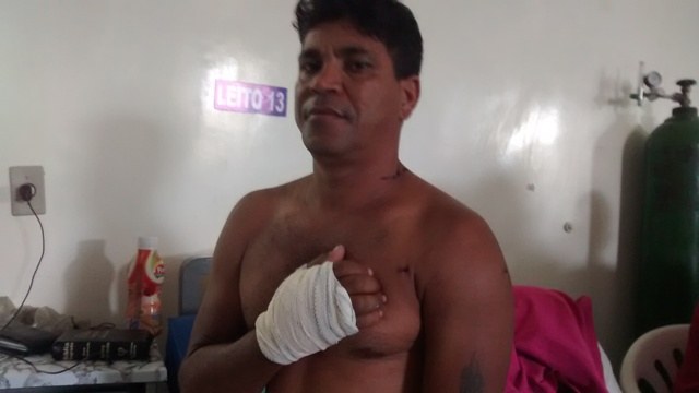Pintor que sobreviveu a tentativa de homicídio diz não ter desavença com ninguém