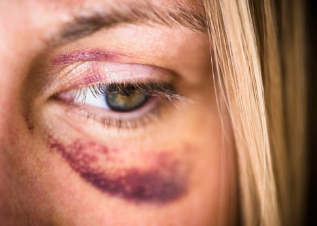 Mulher dá entrada em hospital de Vilhena após ser agredida em “boca-de-fumo”