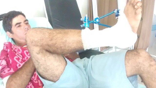 Vaqueiro sofre fratura exposta ao ser derrubado por burro em Chupinguaia
