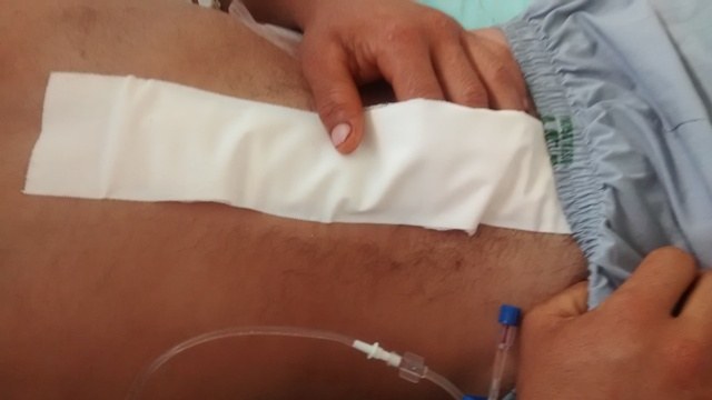 Jovem é operado em Vilhena após bater moto contra ônibus em Chupinguaia