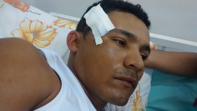 Homem cai de burro em Corumbiara e chega inconsciente a hospital de Vilhena