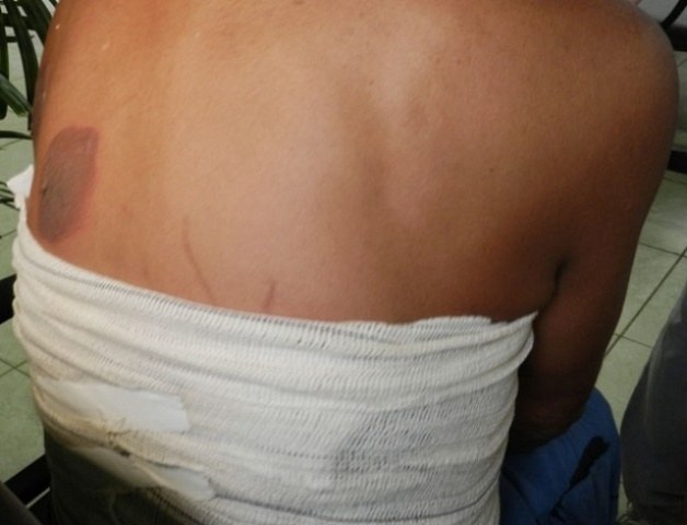 Homem de 27 anos é baleado em sua própria casa no bairro São José, em Vilhena