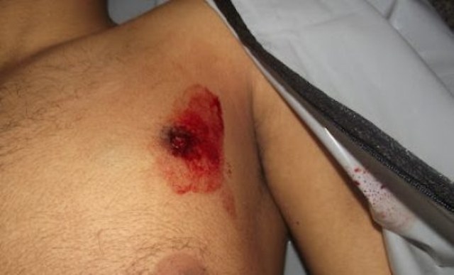 Homem é baleado no centro de Vilhena; atirador estava na garupa de moto