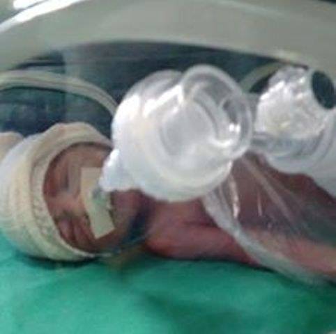 Lucas Gabriel: nasce no Paraná bebê de vilhenense que luta contra doença rara