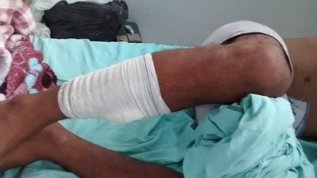 Homem de 33 anos tem testículo atingido por tiro acidental em Corumbiara