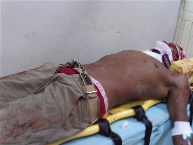 JOVEM É APEDREJADO ATÉ A MORTE EM VILHENA