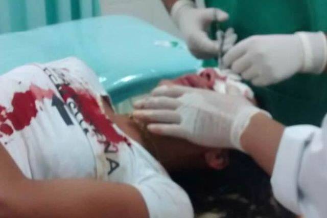 Polícia de RO procura homem que desfigurou rosto de mulher a golpes de capacete