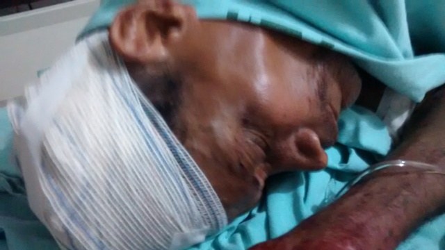 Por causa de R$ 300, músico de 53 anos quase foi morto a pancadas em Vilhena