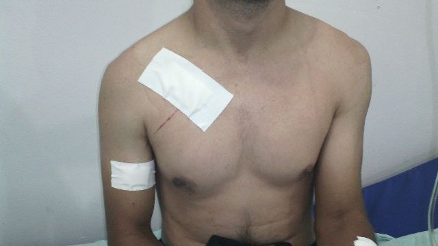 Agente ferido durante rebelião de menores em Vilhena revela tentativa de fuga