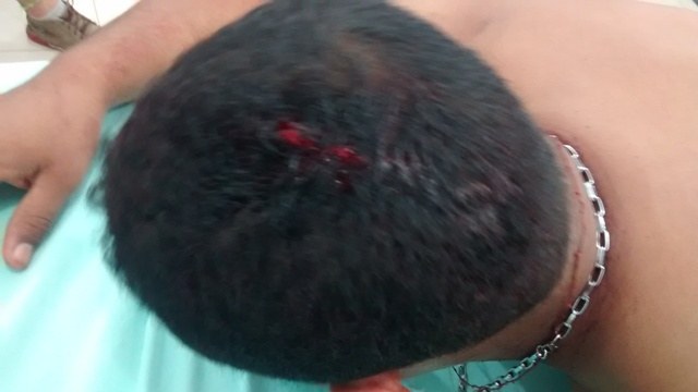 Jovem é atingido por garrafada em briga generalizada em chácara
