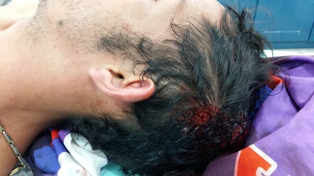 Vihena: jovem espancado é encontrado desmaiado em show de dupla sertaneja