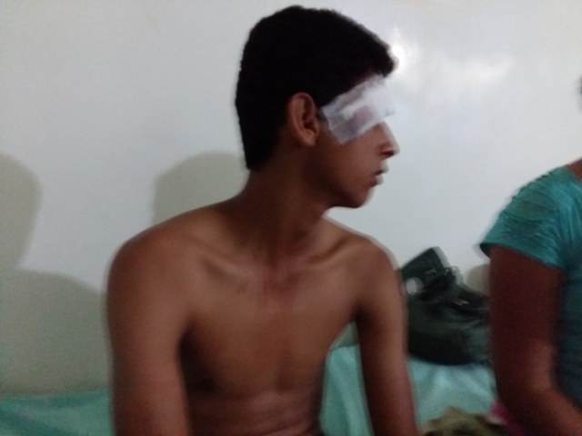 Adolescente vilhenense pega carona em carreta e fica ferido em acidente
