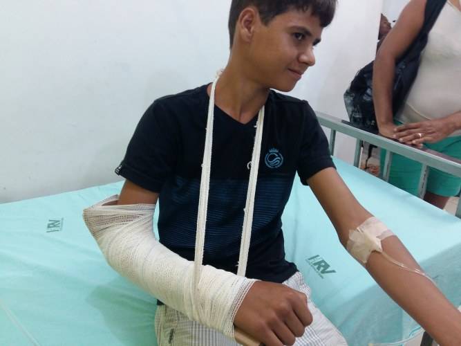Garoto de 16 anos fratura braço ao cair de touro no distrito do Guaporé